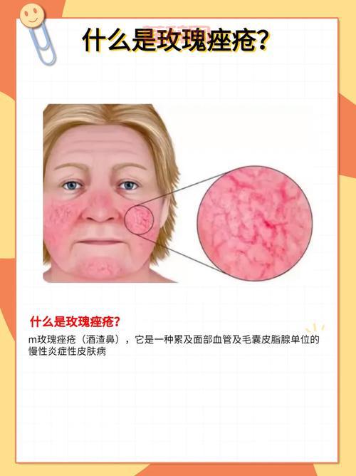 皎月皮肤手感全面测评，最好用的皮肤竟然是它？